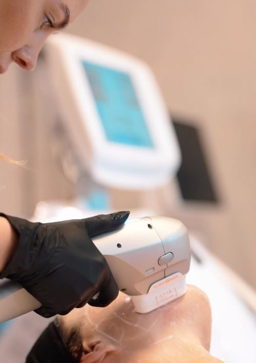 Tratamiento Liftera HIFU facial en Azala